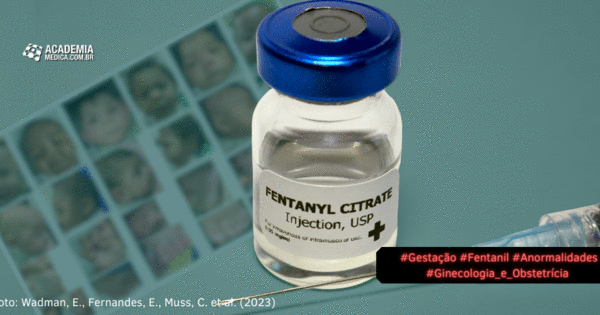 Características físicas em bebês ligadas ao uso de fentanil na gravidez são  investigadas - Academia Médica