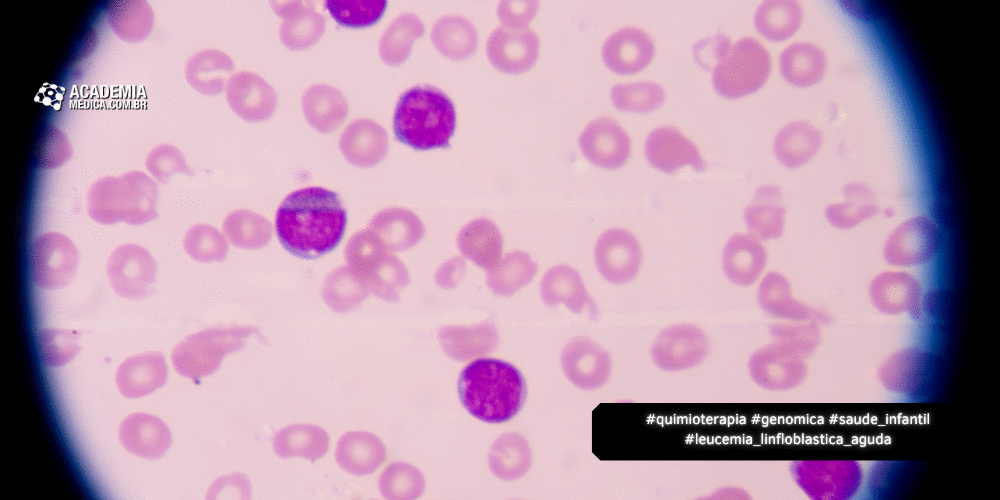 Avanços Genômicos no Tratamento da Leucemia Linfoblástica Aguda