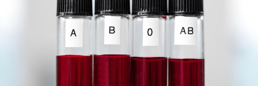 Estudo sugere que tipo sanguíneo pode prever risco de AVC precoce