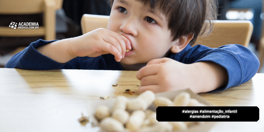 Alergias: Como Pais Entendem e Aplicam Introdução Precoce do Amendoim