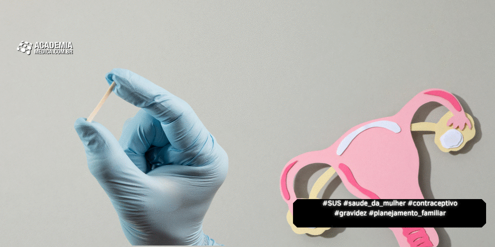 SUS vai Oferecer Implanon: Contraceptivo de Longa Duração