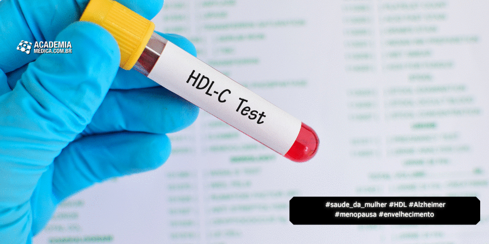 Qualidade Versus Quantidade de HDL: Implicações para Risco de Alzheimer