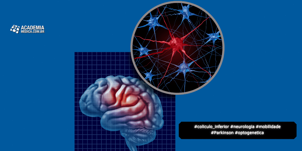 Mobilidade e Plasticidade Neural: Novos Achados em Parkinson 