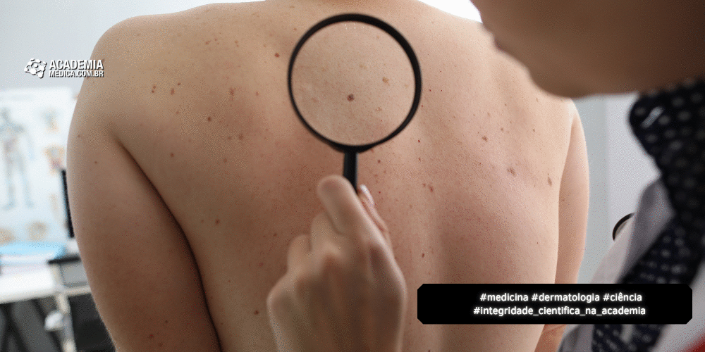 HIN: Diagnóstico Visual em Dermatologia Hospitalar