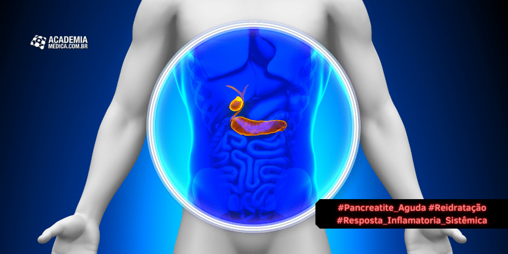 Pancreatite Aguda: A abordagem delicada da reidratação