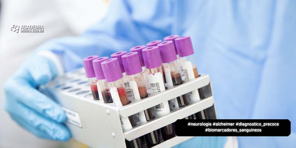 FDA aprova 1º teste sanguíneo para Diagnóstico Precoce do Alzheimer