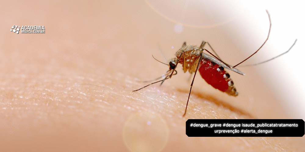 Dengue Grave: O Que Você Precisa Saber