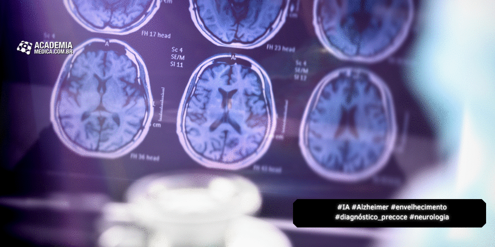IA Surpreende na Previsão do Alzheimer