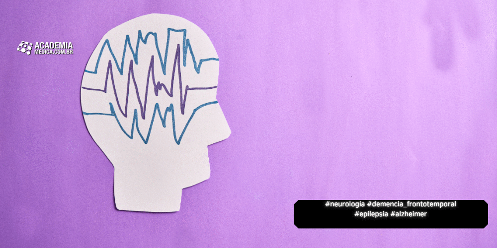 Epilepsia e a Demência Frontotemporal 