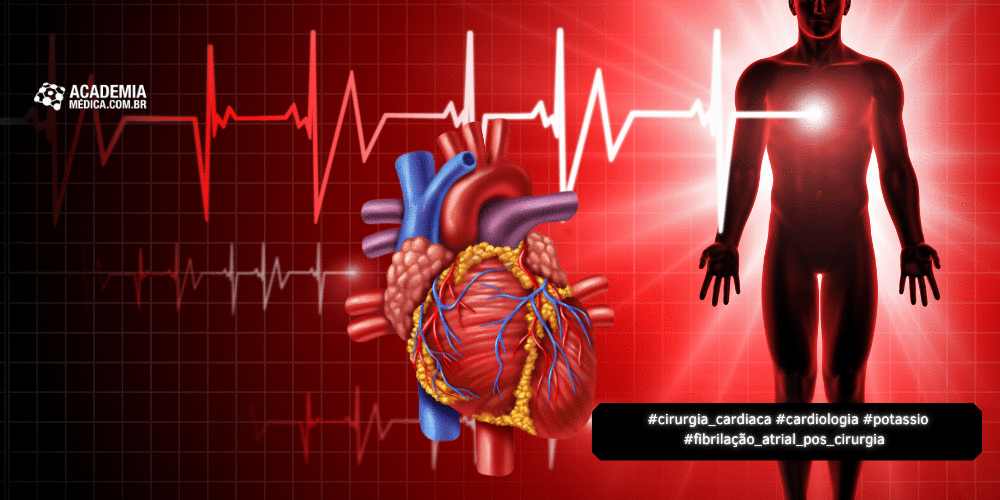 Suplementação de Potássio no Desfecho da Fibrilação Atrial Pós-Cirurgia Cardíaca