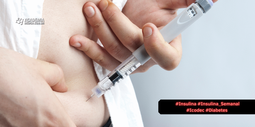 Promessa na DM-2: Insulina Icodec SEMANAL supera insulina diária em estudo clinico randomizado