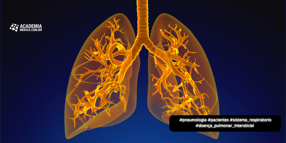 Doença Pulmonar Intersticial 