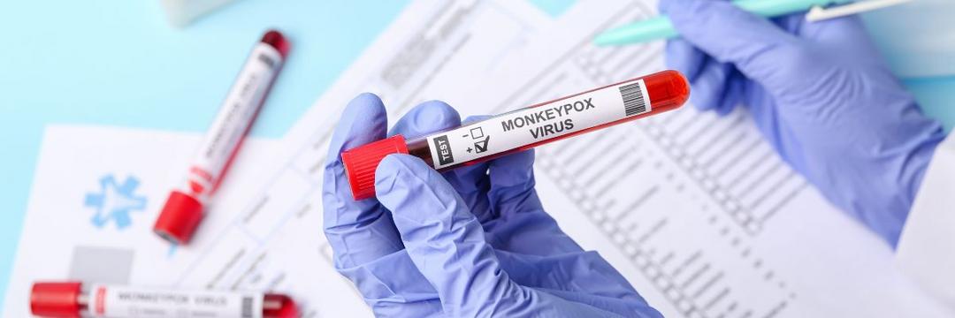 Testes diagnósticos de varíola dos macacos são avaliados pela Anvisa