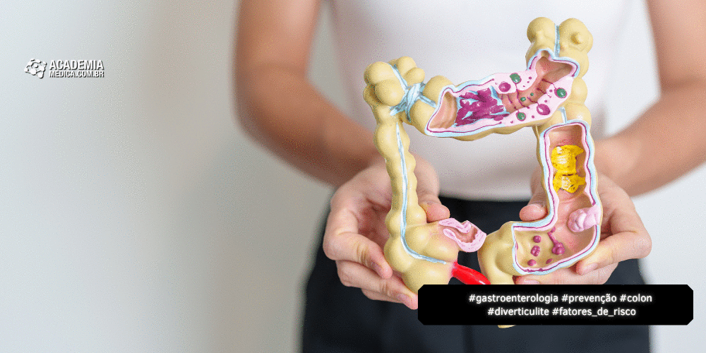 Revisão Prática Sobre Diverticulite