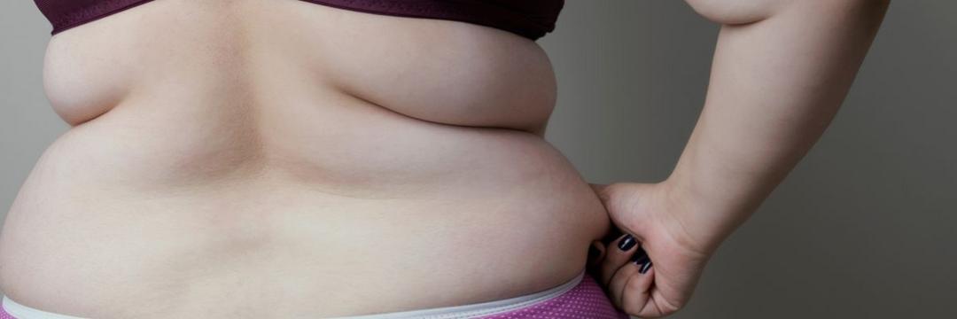 Metade da população mundial será obesa até 2035