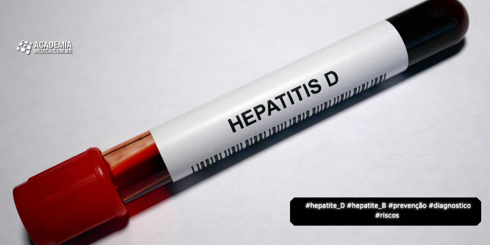 Hepatite D: Riscos, Diagnóstico e Prevenção