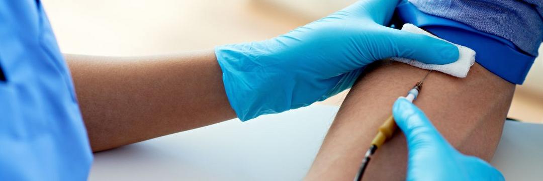 Japão aprova teste de sangue para detecção da doença de Alzheimer