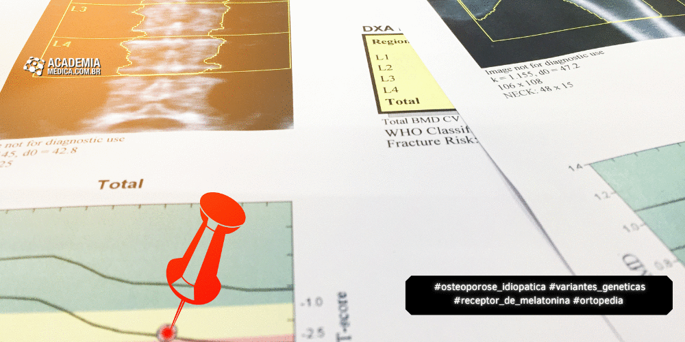 Estudo analisa Variantes do Receptor de Melatonina na Osteoporose Idiopática