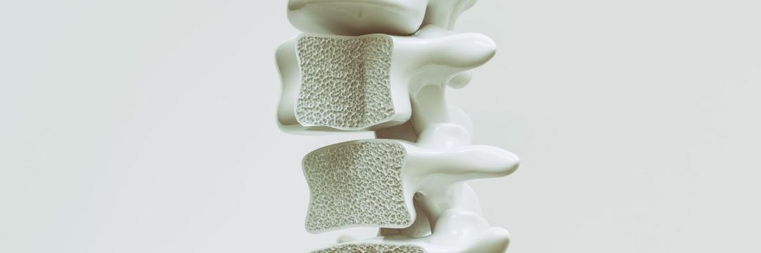 Novo composto oral se mostra promissor para tratamento da osteoporose 