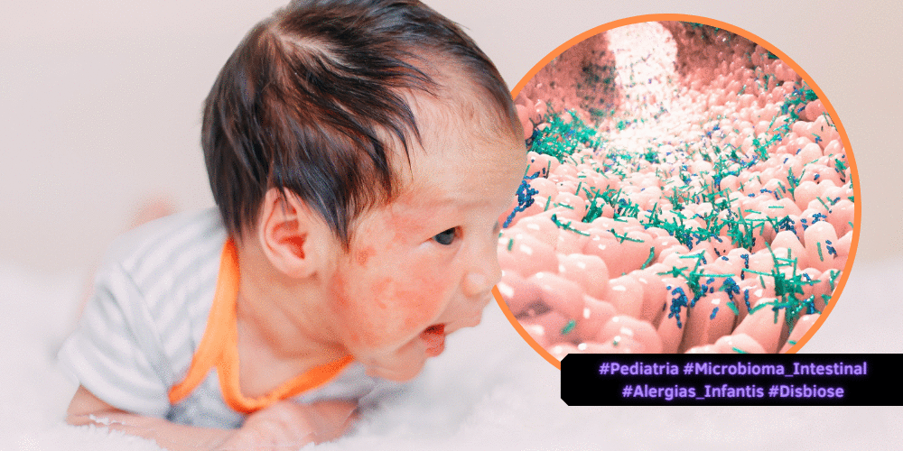 O Microbioma Intestinal: A Origem das principais alergias infantis