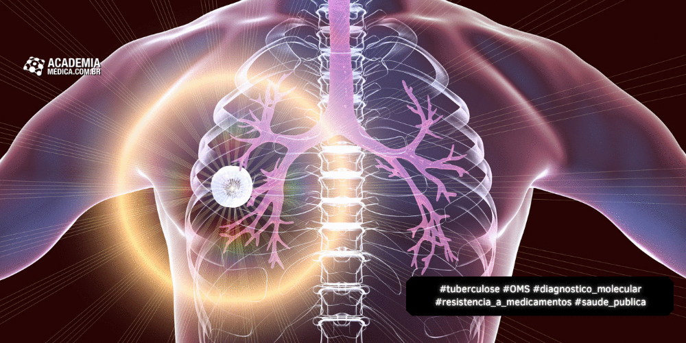 Primeiro Teste de Tuberculose Recebe Pré-qualificação da OMS