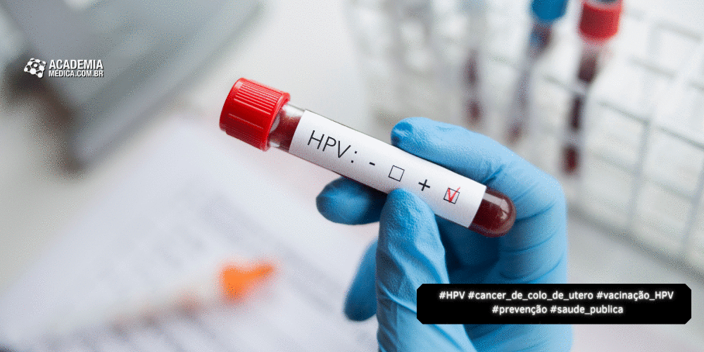 Como o HPV Pode se Manifestar: Informações Para Prevenção