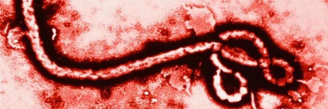 Surto de ebola em Uganda completa um mês. País tem 109 casos positivos e 30 mortes