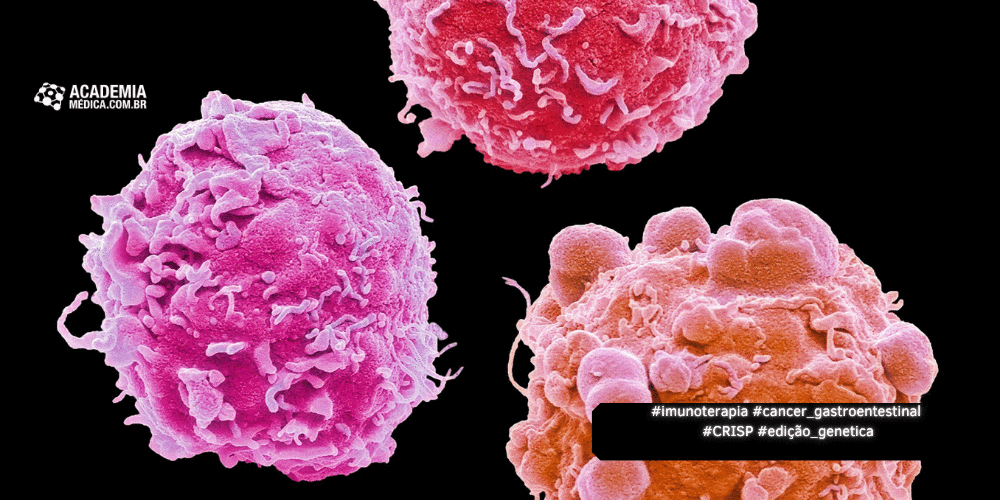 Edição Genética com CRISPR Impulsiona Imunoterapia para Câncer Gastrointestinal
