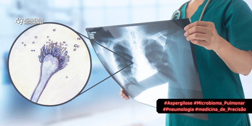 Doença de Aspergilose: Interação entre aspergillus fumigatus e  microbioma pulmonar