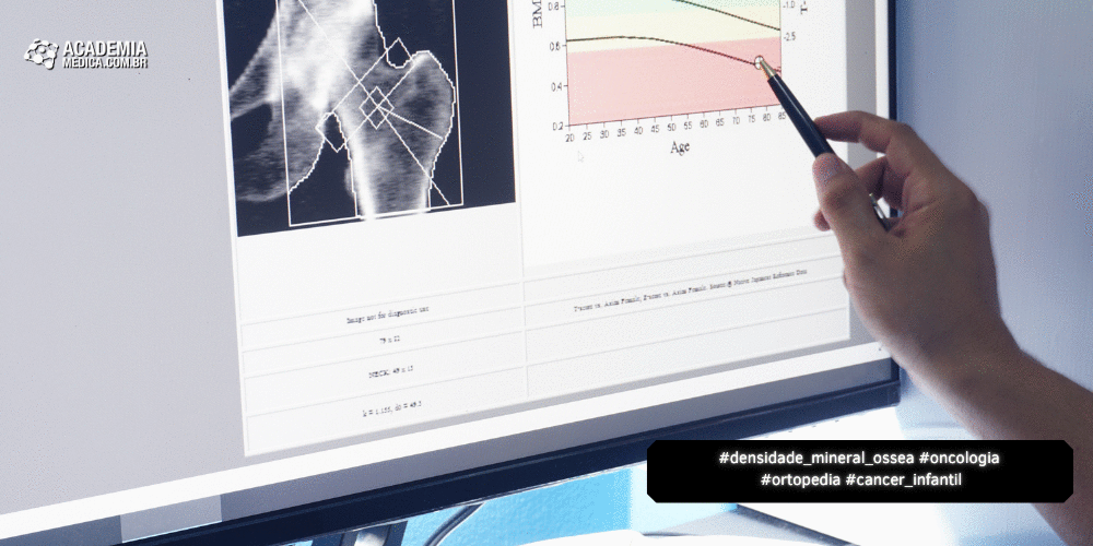 Saúde Óssea em Sobreviventes de Câncer Infantil