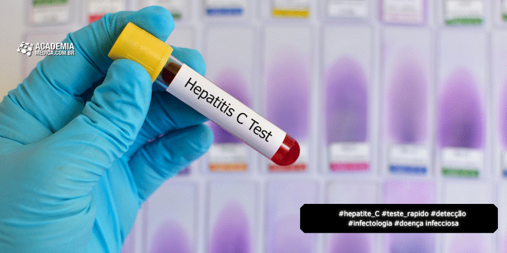 Northwestern Cria Teste de Hepatite C com Resultado em 15 Minutos