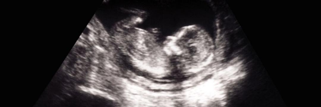 Estudo demonstra que fetos reagem a cheiros e sabores de alimentos consumidos pelas mães