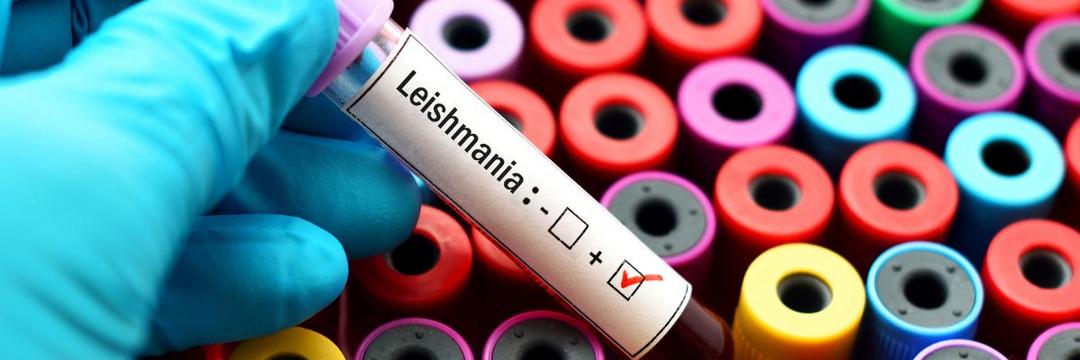 Estudo da Fiocruz Bahia mostra que medicamento para diabetes pode auxiliar no tratamento da leishmaniose cutânea