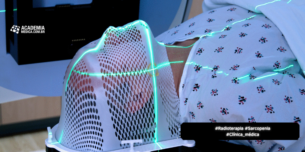 RADIOTERAPIA E SARCOPENIA: Uma Via de Mão Dupla