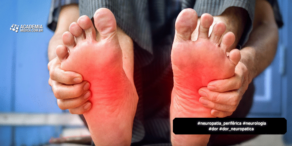 Neuropatia Periférica: Atualizações JAMA Clinical Reviews