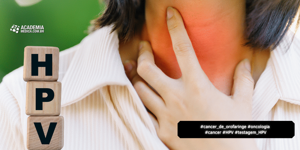 HPV e Câncer de Orofaringe