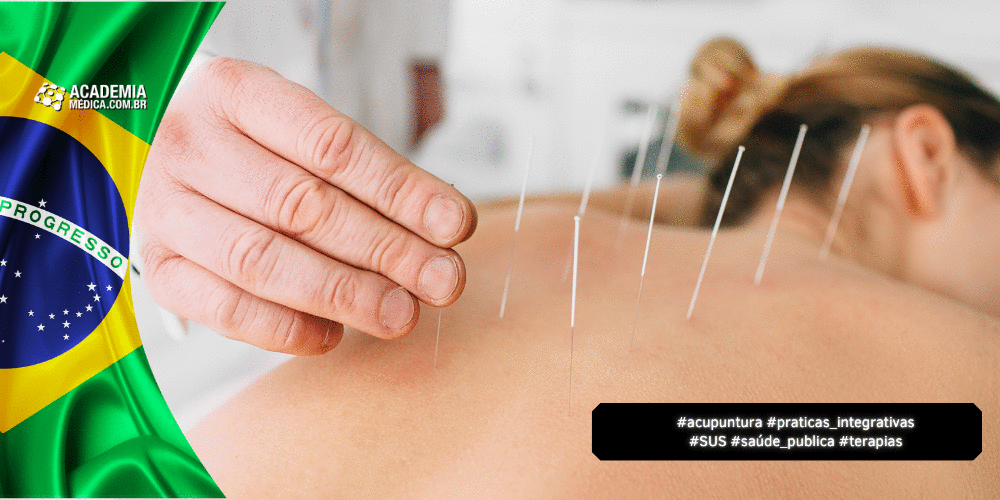 Nova Lei Regulamenta Acupuntura e Define Quem Pode Exercer a Prática