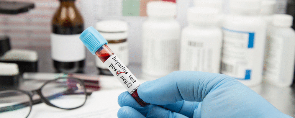 Após confirmar mais 169 casos de hepatite aguda de origem desconhecida em 12 países, OMS monitora situação